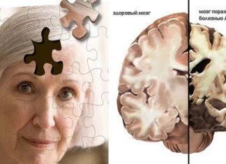 Страна Альцгеймера