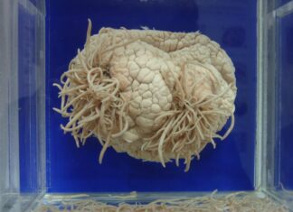 Это многое объясняет: Амебы, пожирающие мозг, распространяются на север США